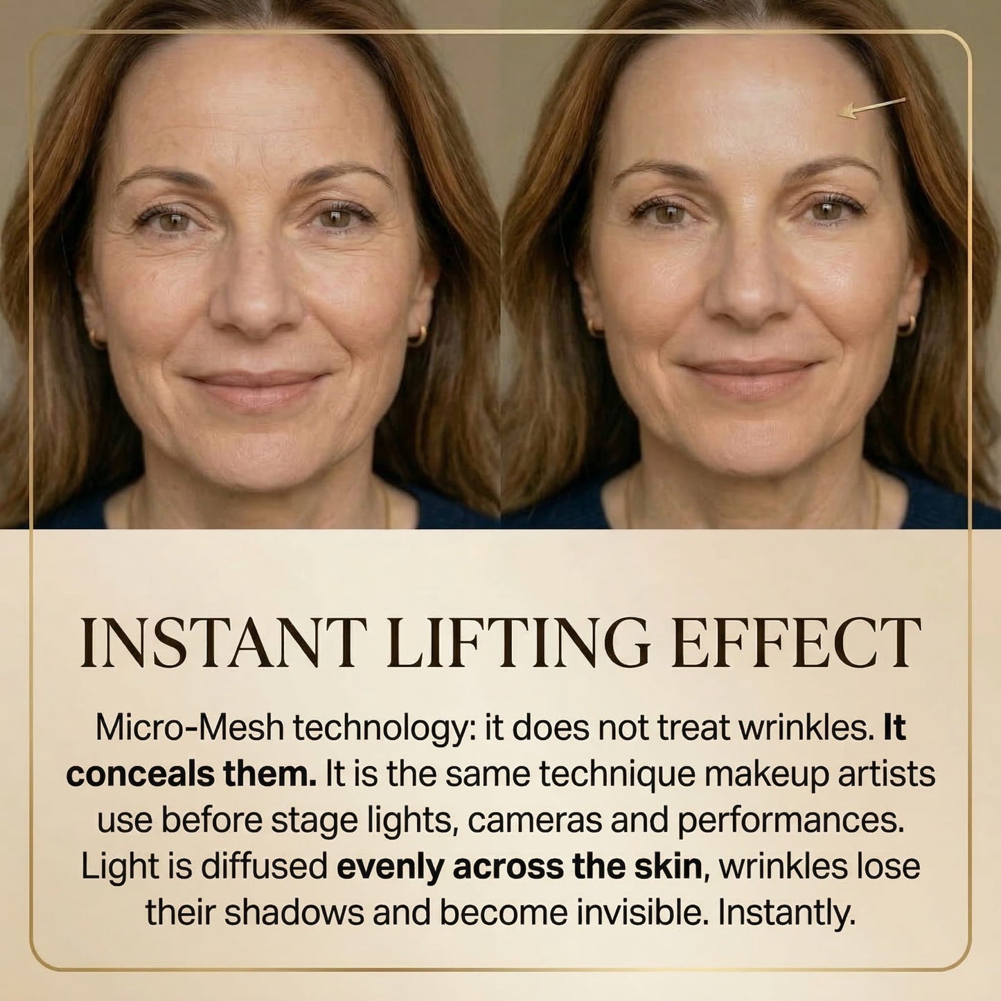 Khleopatra - Illuminating filling micro-mesh gel